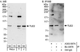 Detection of human TLE2 by WB and IP.