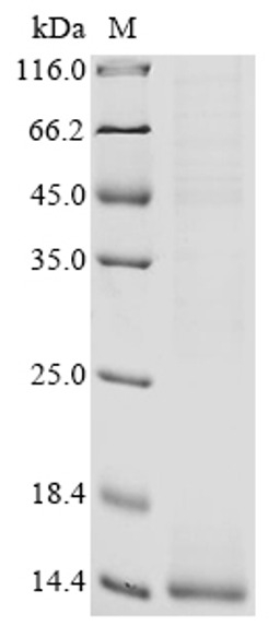 (Tris-Glycine gel) Discontinuous SDS-PAGE (reduced) with 5% enrichment gel and 15% separation gel.