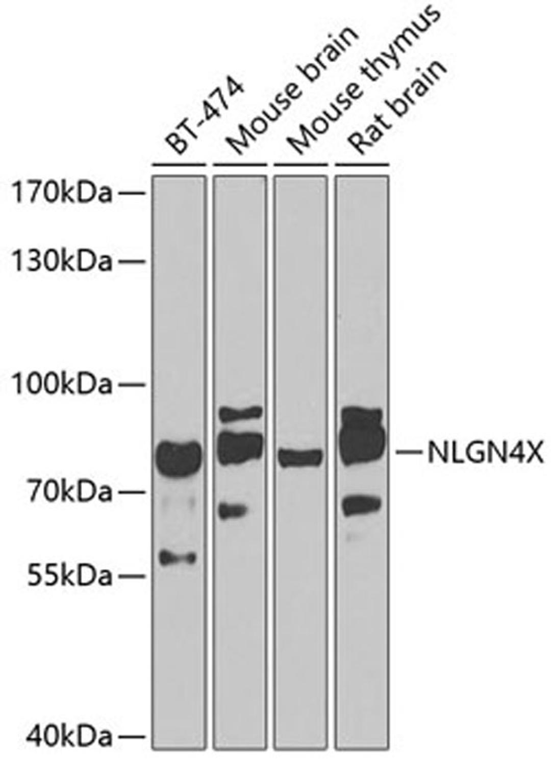 Western blot - NLGN4X antibody (A7986)