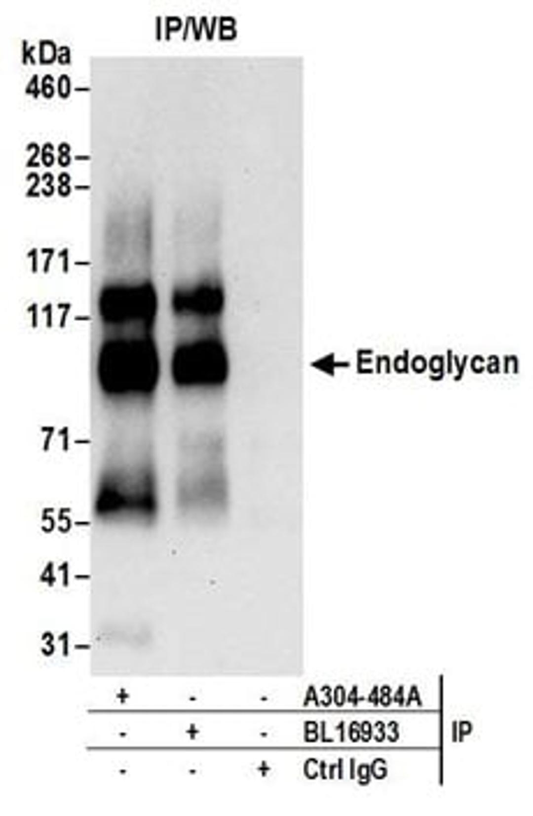 Detection of human Endoglycan by western blot of immunoprecipitates.