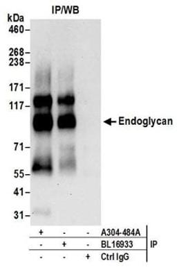 Detection of human Endoglycan by western blot of immunoprecipitates.