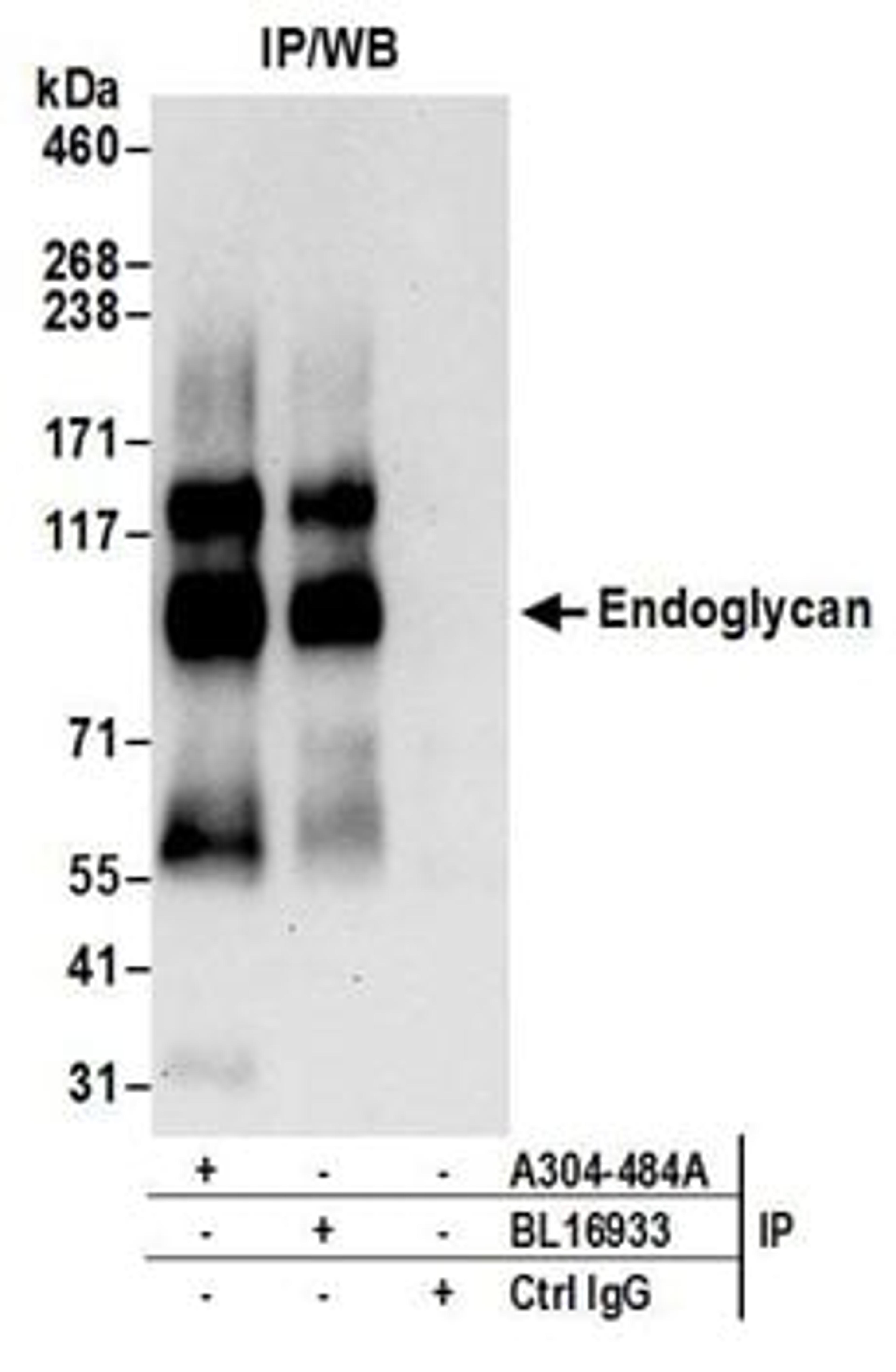 Detection of human Endoglycan by western blot of immunoprecipitates.