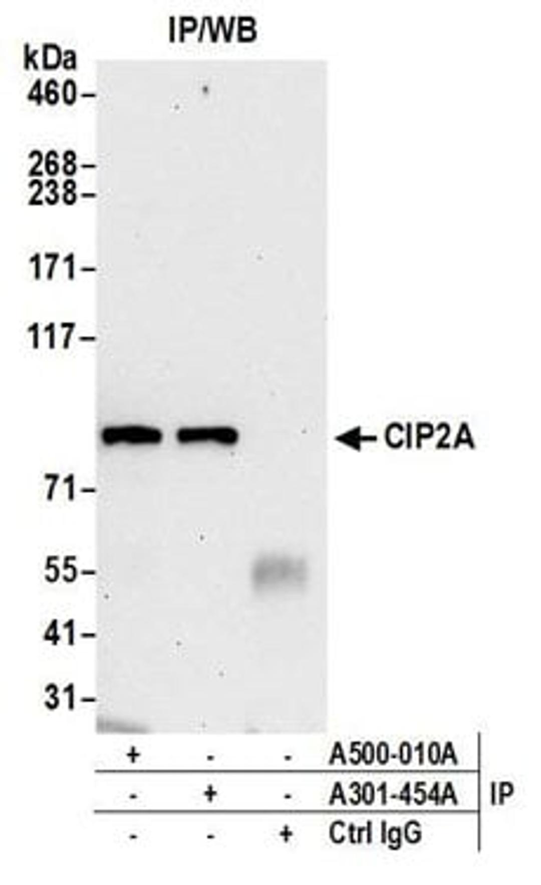 Detection of human CIP2A by western blot of immunoprecipitates.