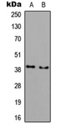 Western blot analysis of COLO205 (Lane 1), NIH3T3 (Lane 2) whole cell lysates using DGAT2L3 antibody