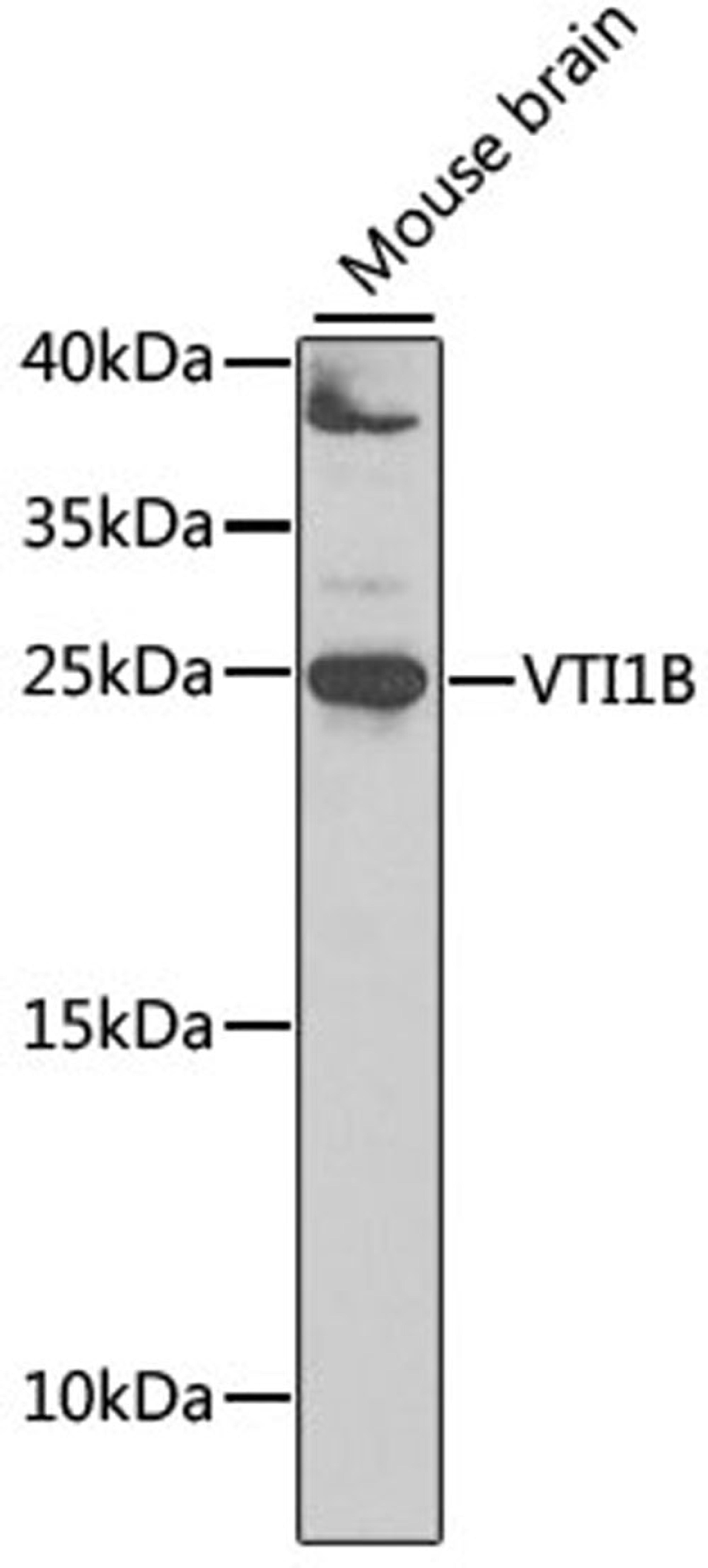 Western blot - VTI1B antibody (A7062)