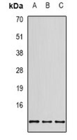 Western blot analysis of SHSY5Y (Lane 1), MCF7 (Lane 2), HEK293T (Lane 3) whole cell lysates using RPS20 antibody