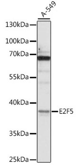 Western blot - E2F5 antibody (A16042)