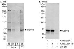 Detection of human CEP76 by western blot and immunoprecipitation.