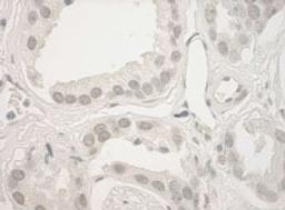 Detection of human Haspin by immunohistochemistry.