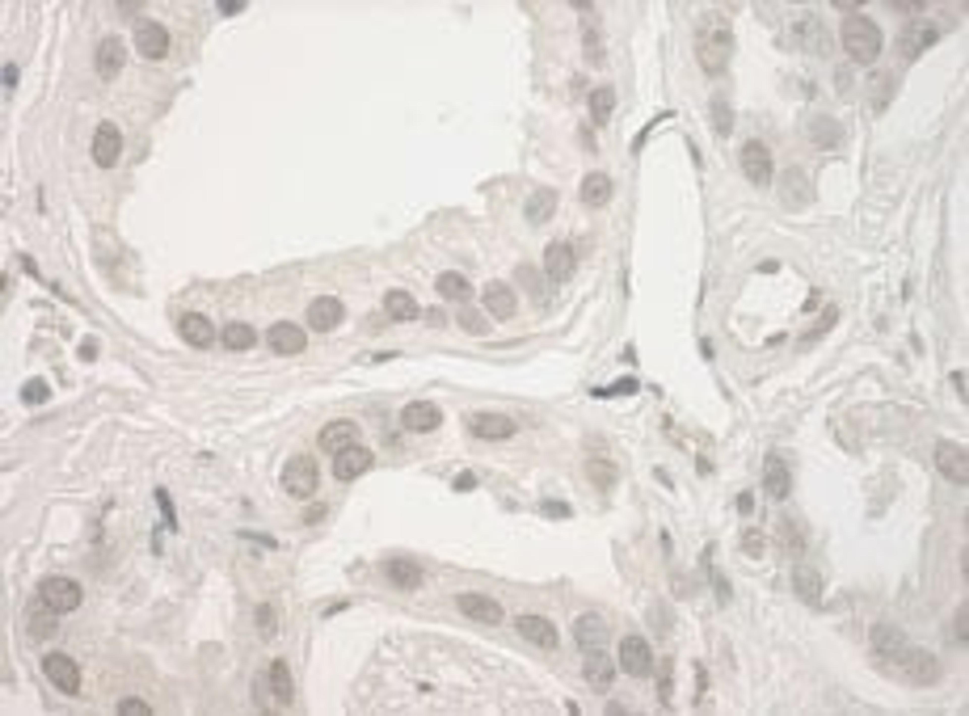 Detection of human Haspin by immunohistochemistry.