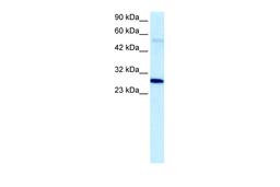 Antibody used in WB on Human Jurkat 5.0 ug/ml.