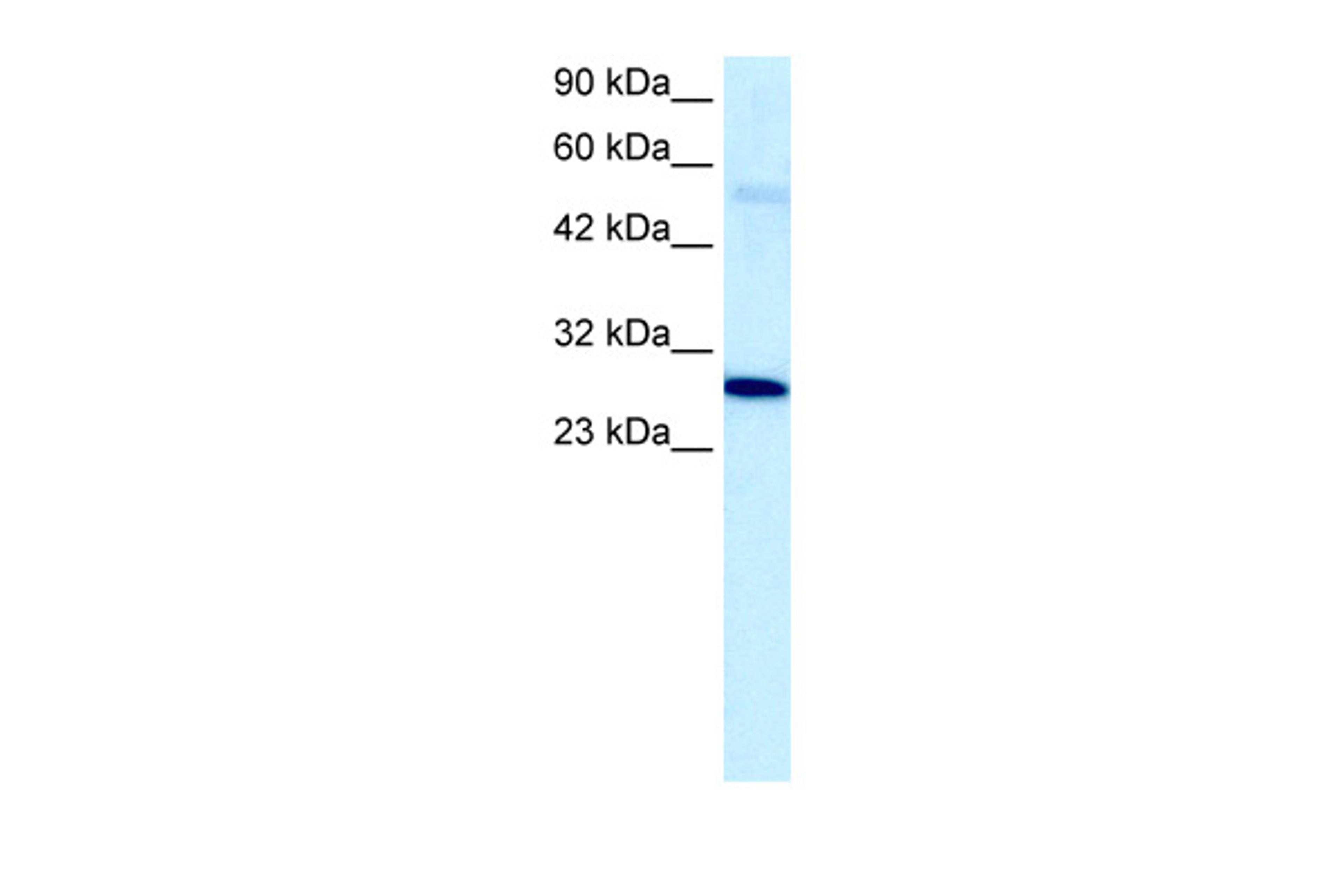 Antibody used in WB on Human Jurkat 5.0 ug/ml.