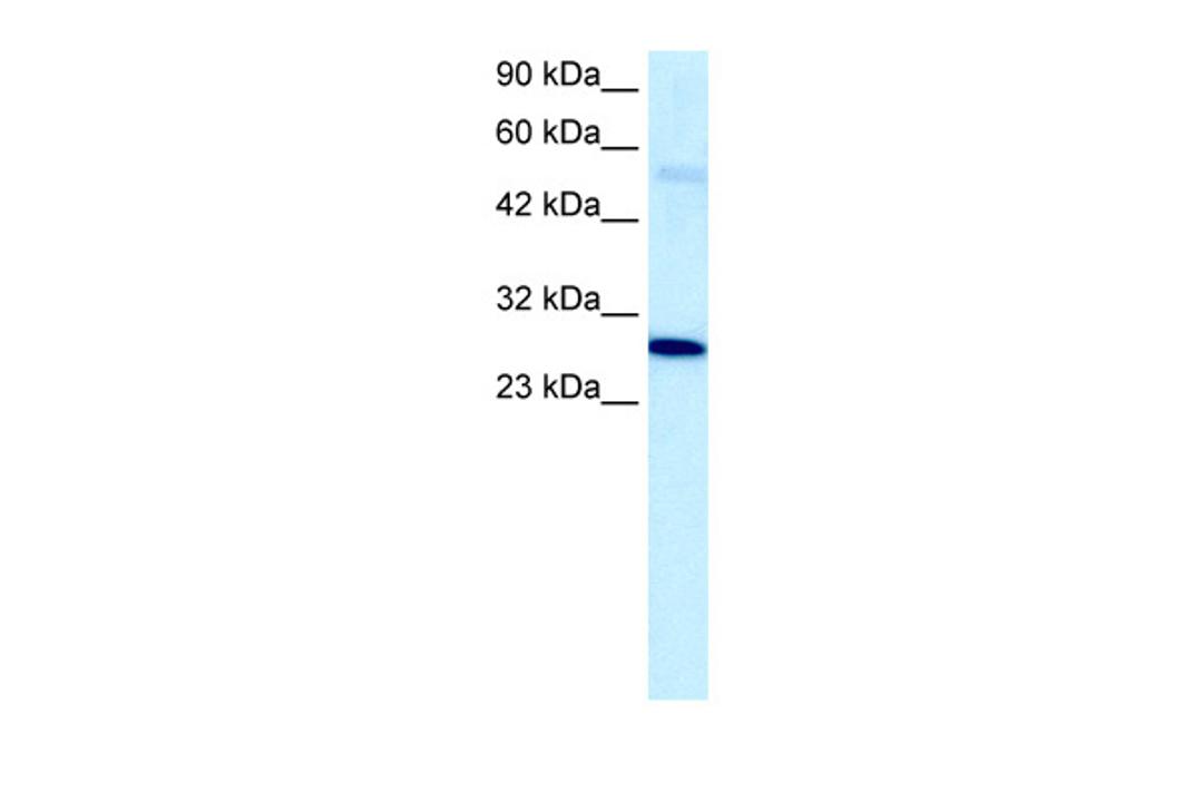 Antibody used in WB on Human Jurkat 5.0 ug/ml.
