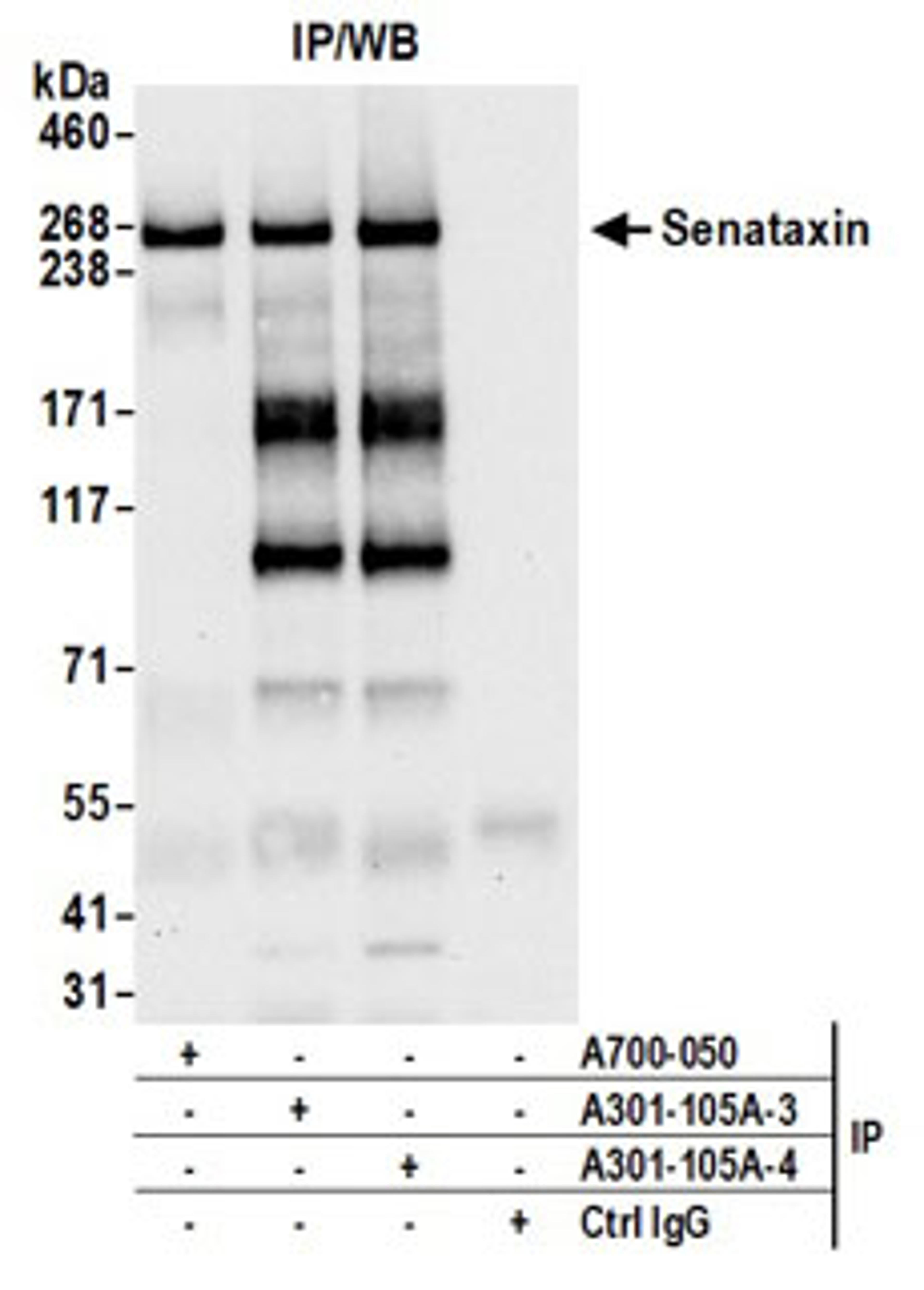 Detection of human Senataxin by western blot of immunoprecipitates.