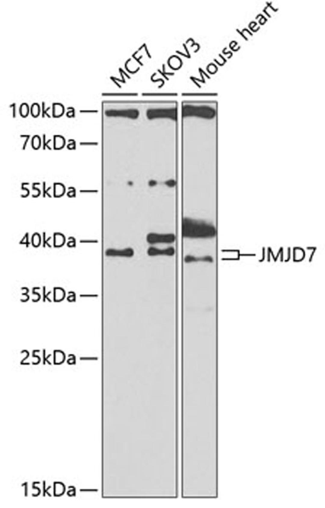 Western blot - JMJD7 antibody (A7408)