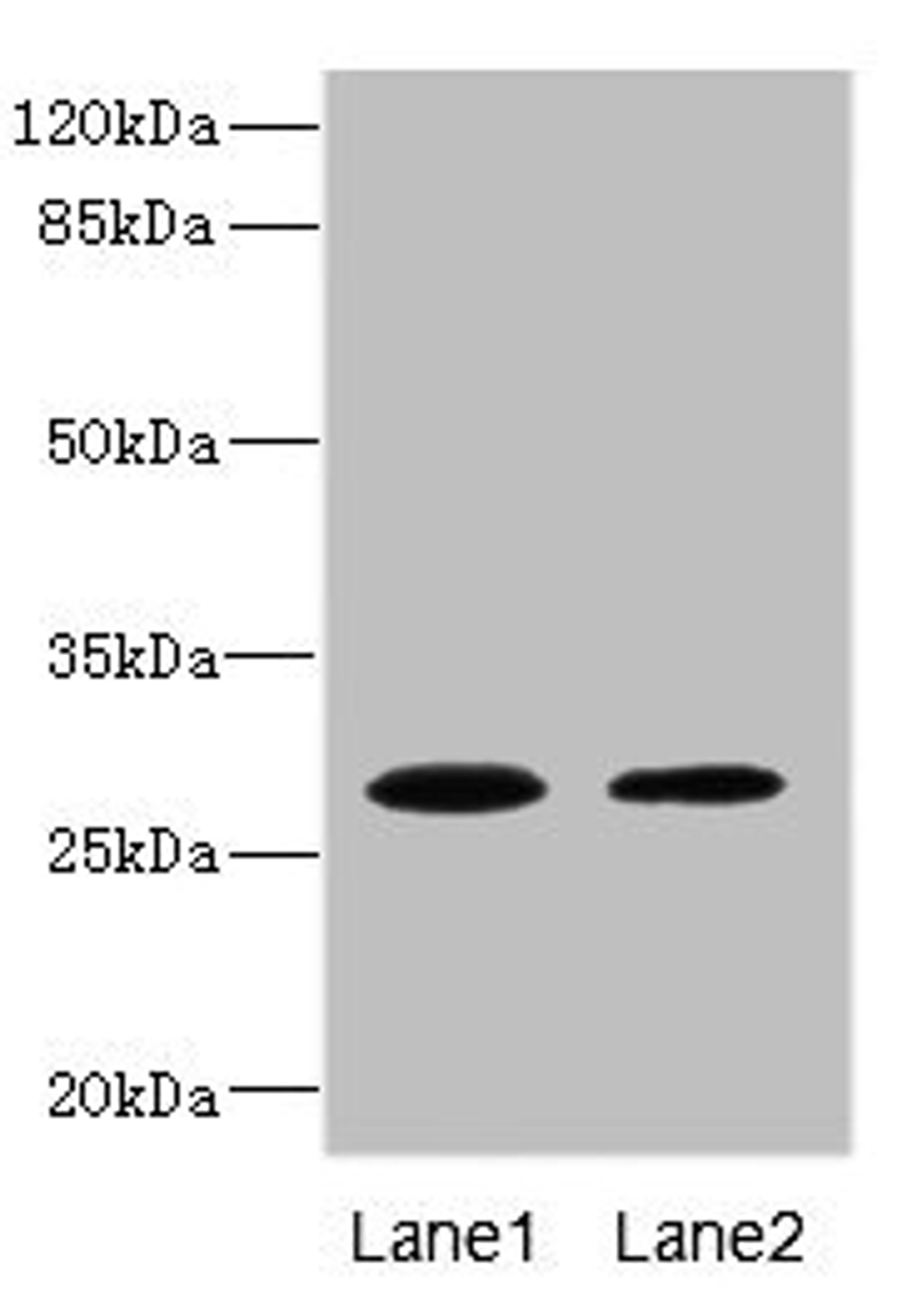 Western blot. All lanes: TPK1 antibody at 0.78ug/ml. Lane 1: Mouse liver tissue. Lane 2: Mouse kidney tissue. Secondary. Goat polyclonal to rabbit IgG at 1/10000 dilution. Predicted band size: 28, 14 kDa. Observed band size: 28 kDa.