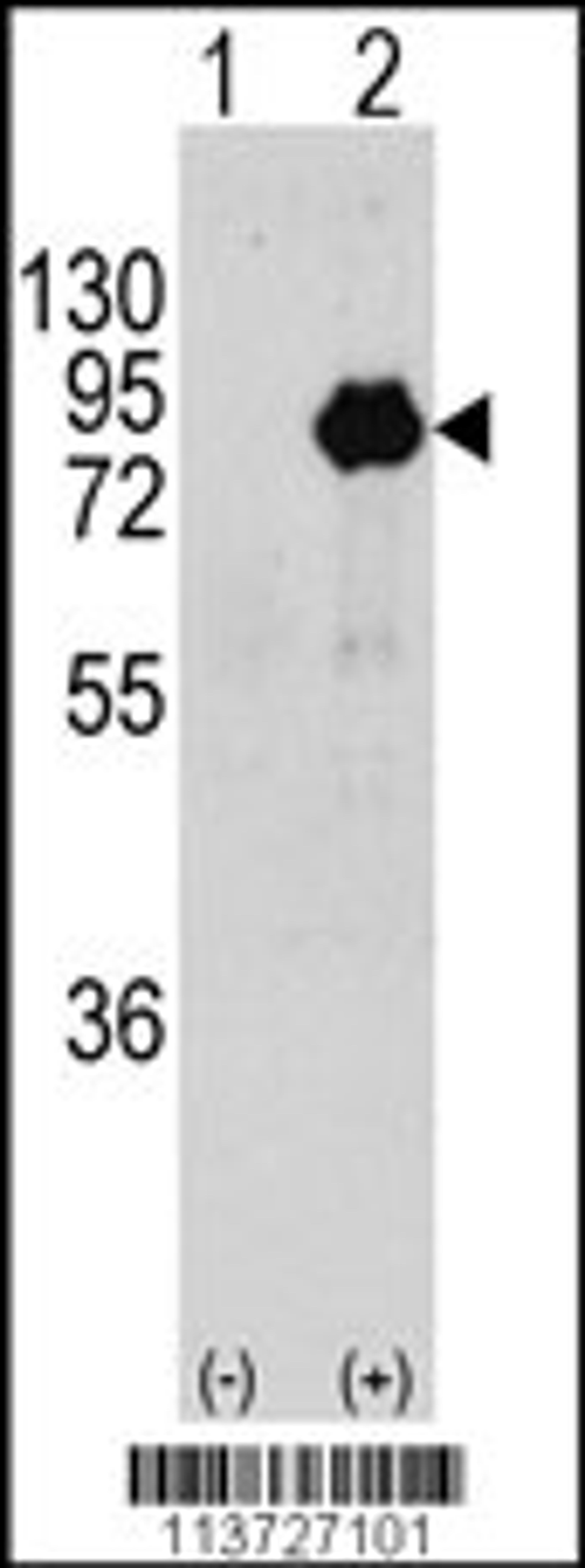 Western blot analysis of PIK3R2 using rabbit polyclonal PIK3R2 Antibody (T447) using 293 cell lysates (2 ug/lane) either nontransfected (Lane 1) or transiently transfected with the PIK3R2 gene (Lane 2).