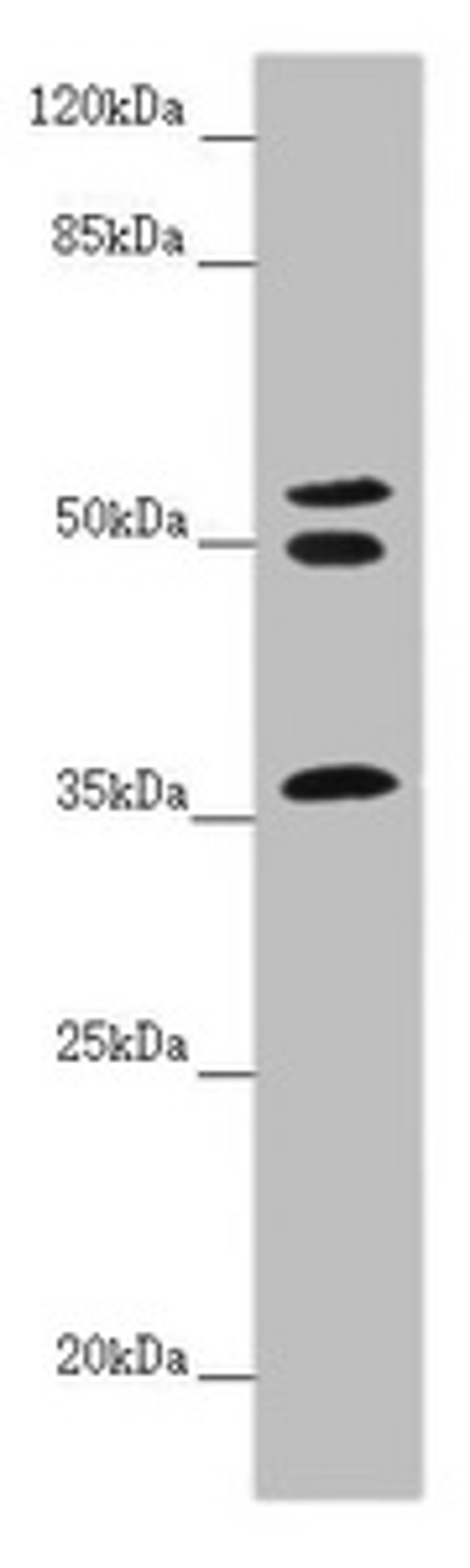 Western blot. All lanes: RNF41 antibody at 5.55 ug/ml + Mouse brain tissue. Secondary. Goat polyclonal to rabbit IgG at 1/10000 dilution. Predicted band size: 36, 28 kDa. Observed band size: 36, 50, 55 kDa. 