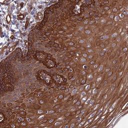 Immunohistochemistry: TULP2 Antibody [NBP2-33459] - Immunohistochemical staining of human esophagus shows strong cytoplasmic positivity in squamous epithelial cells.