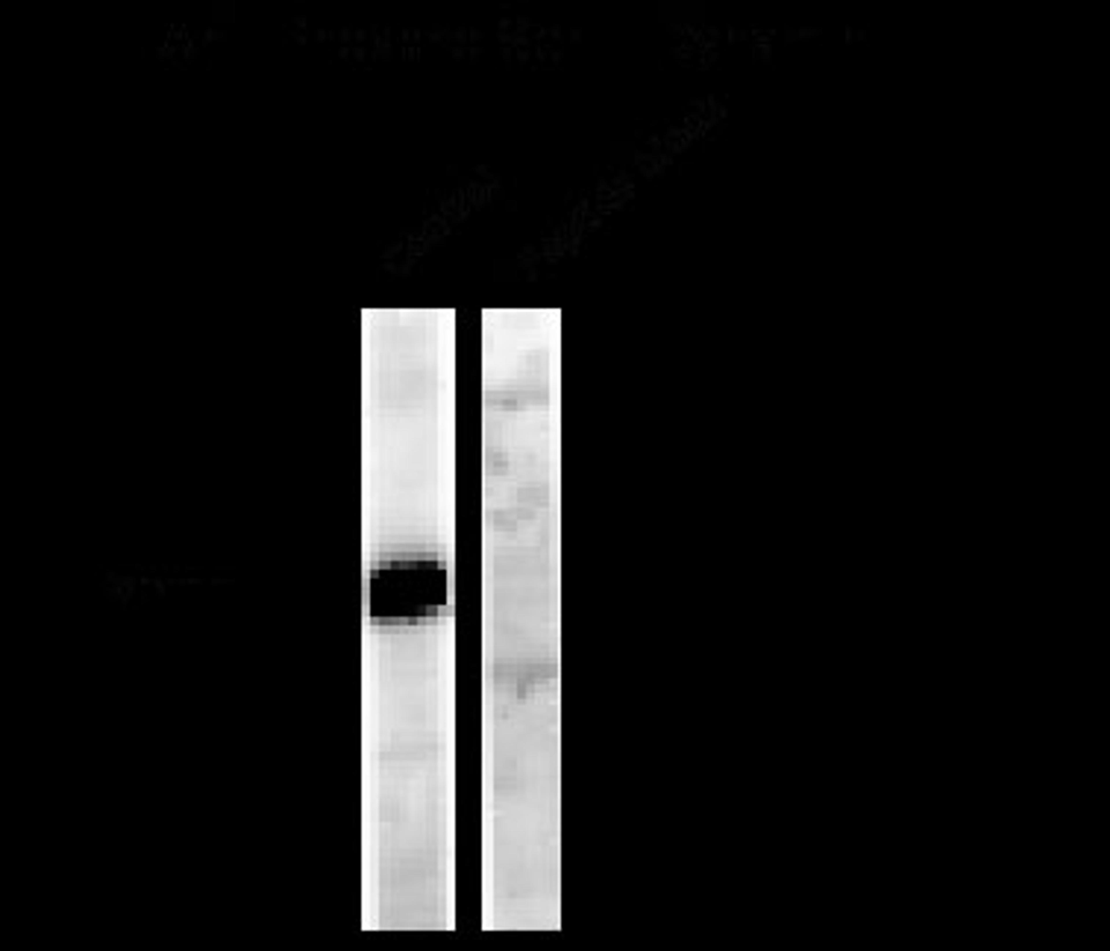 Western blot of a forskolin stimulated rat hippocampal lysate showing phospho-specific immunolabeling of the ~95k Dynamin protein phosphorylated at Ser778.