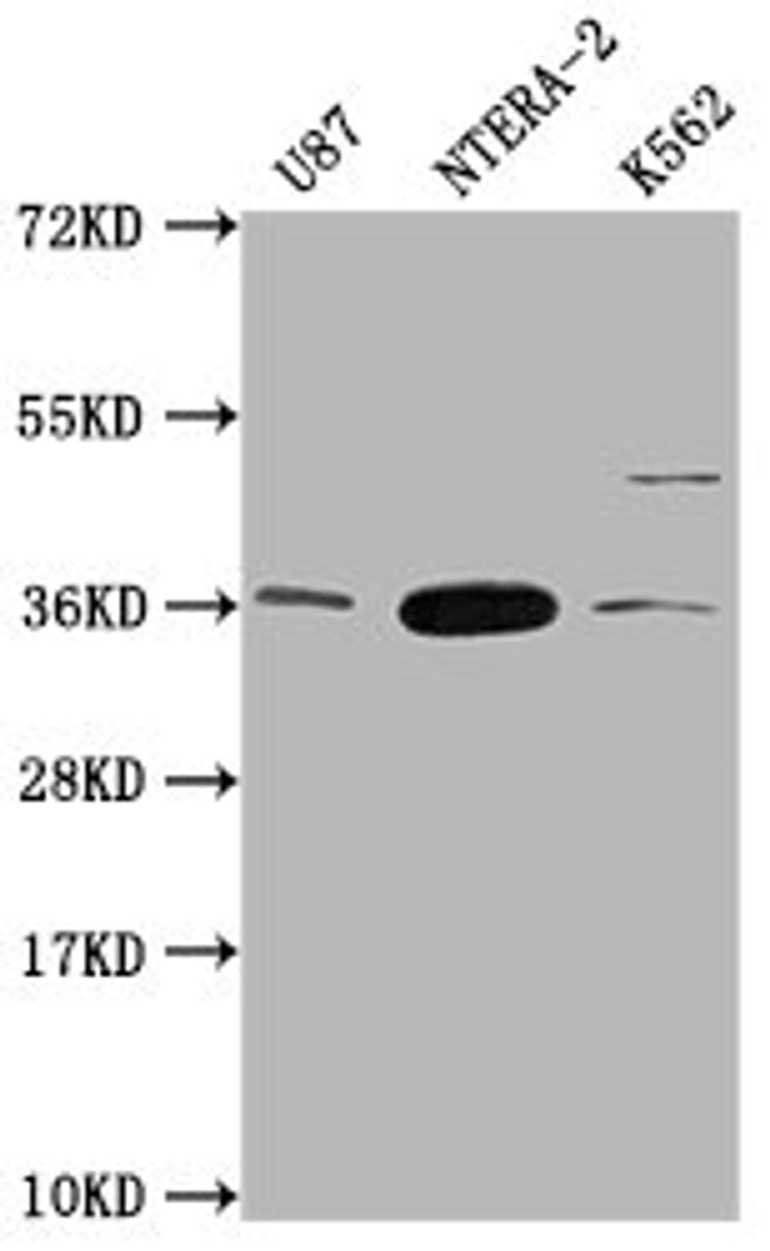 Western Blot. Positive WB detected in: U87 whole cell lysate, NTERA-2 whole cell lysate, K562 whole cell lysate. All lanes: CBY1 antibody at 1:2000. Secondary. Goat polyclonal to rabbit IgG at 1/50000 dilution. Predicted band size: 15 kDa. Observed band size: 35 kDa. 