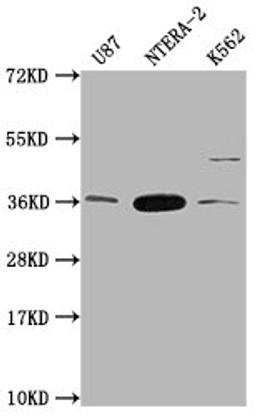 Western Blot. Positive WB detected in: U87 whole cell lysate, NTERA-2 whole cell lysate, K562 whole cell lysate. All lanes: CBY1 antibody at 1:2000. Secondary. Goat polyclonal to rabbit IgG at 1/50000 dilution. Predicted band size: 15 kDa. Observed band size: 35 kDa. 