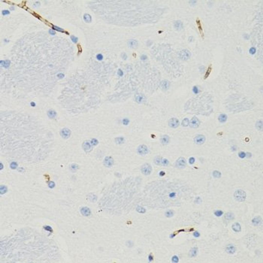 Immunohistochemistry of paraffin-embedded mouse brain tissue using GALT antibody