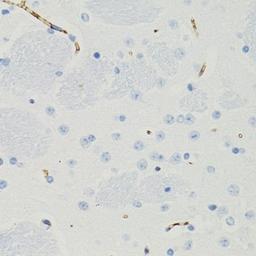 Western blot - GALT Rabbit pAb (A6292)