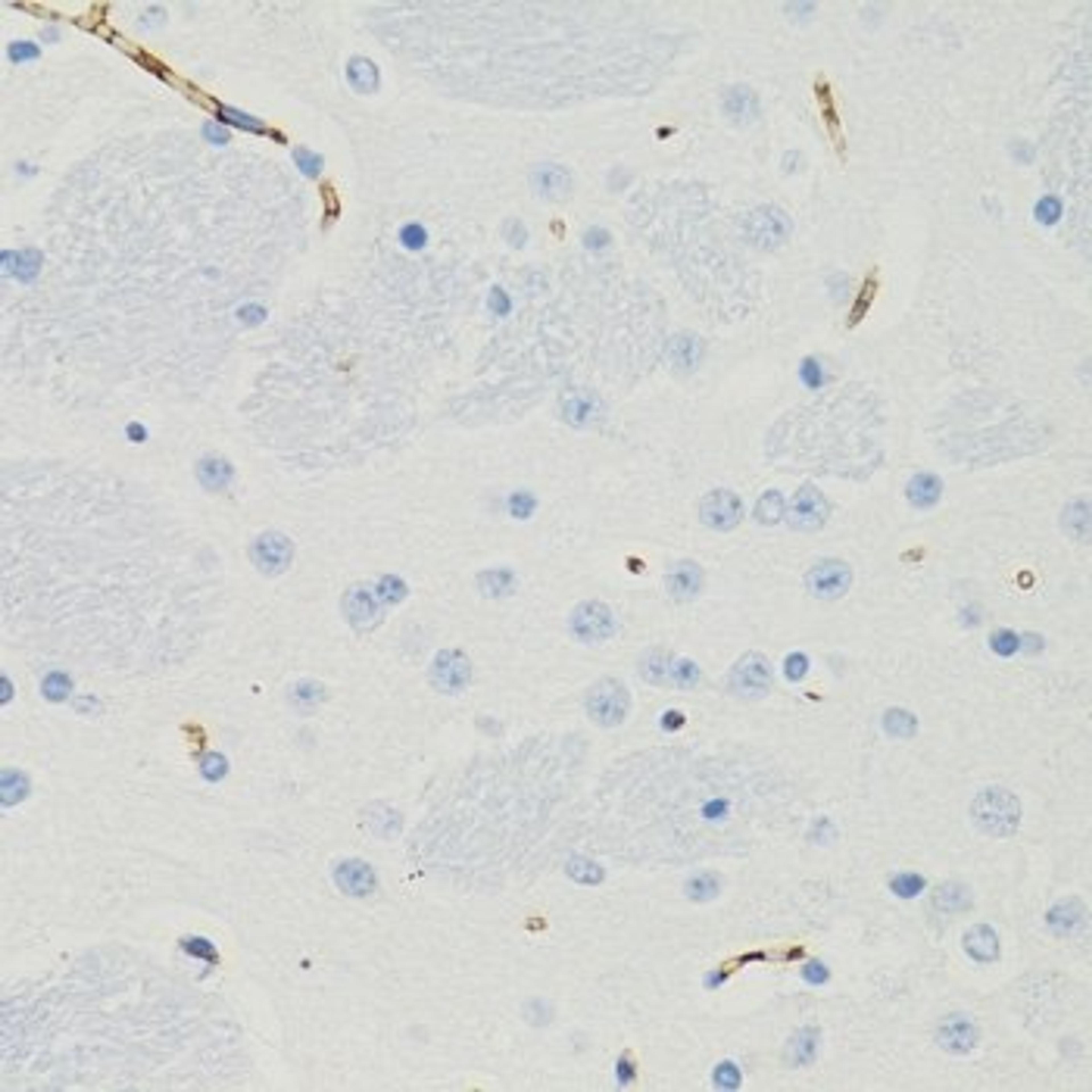 Western blot - GALT Rabbit pAb (A6292)