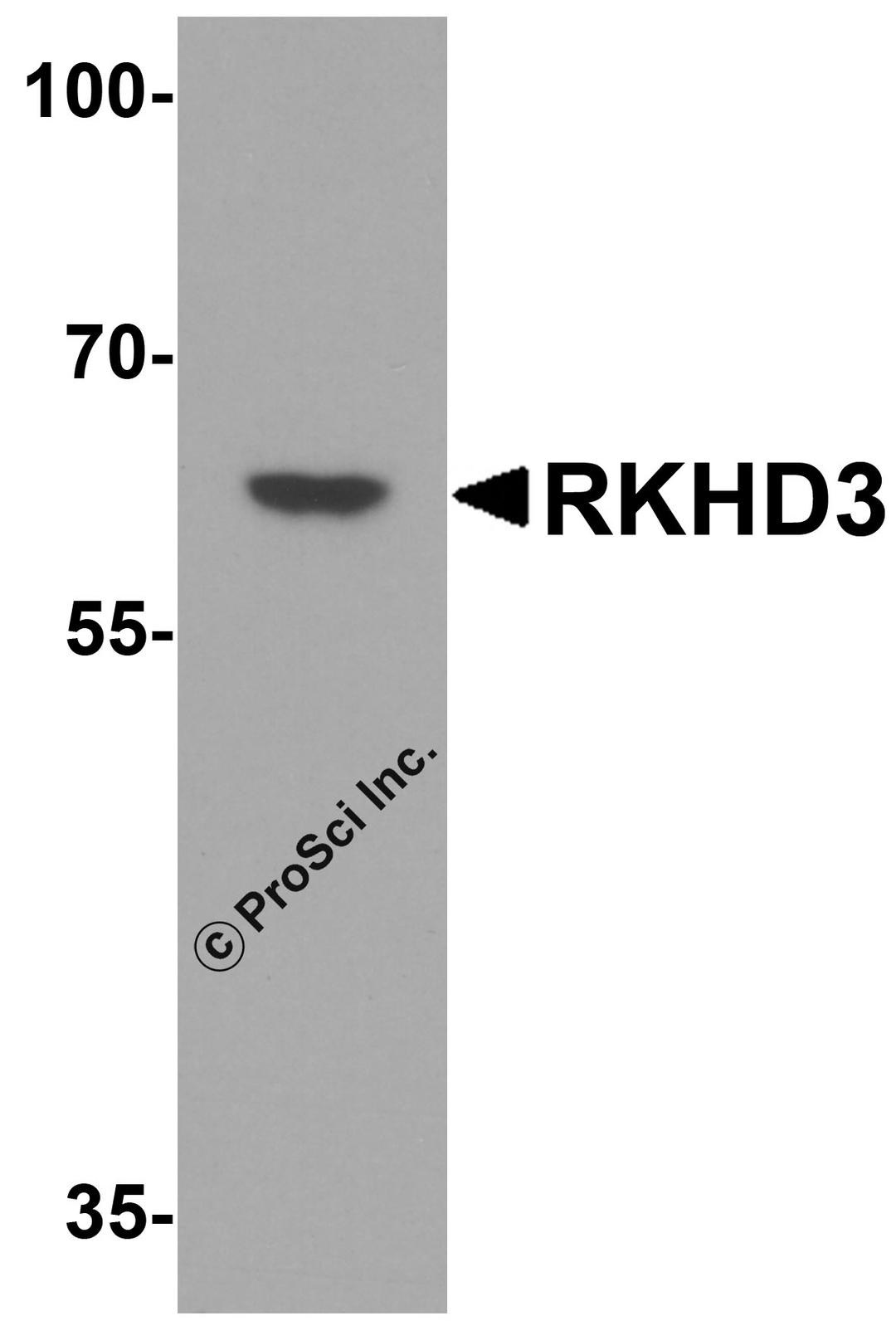 Western blot analysis of RKHD3 in human testis tissue lysate with RKHD3 antibody at 1 μg/mL.