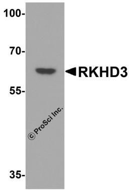 Western blot analysis of RKHD3 in human testis tissue lysate with RKHD3 antibody at 1 μg/mL.