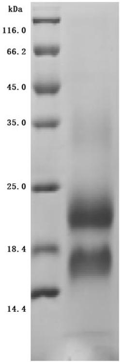 (Tris-Glycine gel) Discontinuous SDS-PAGE (reduced) with 5% enrichment gel and 15% separation gel.