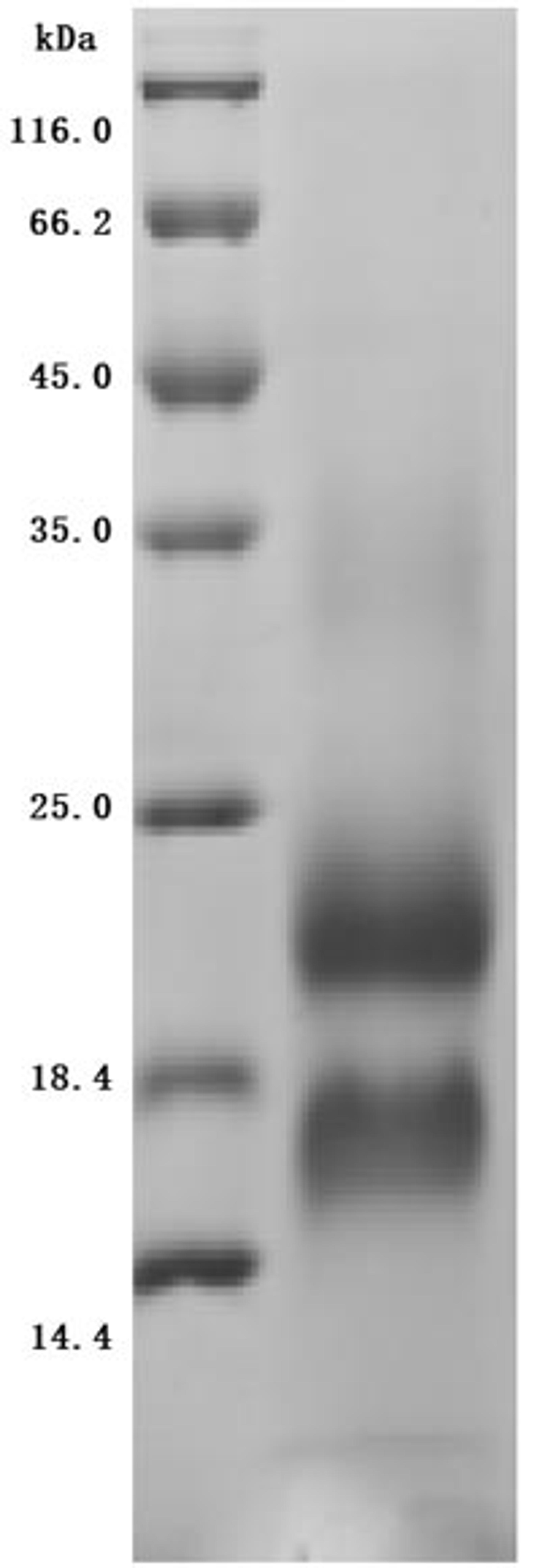 (Tris-Glycine gel) Discontinuous SDS-PAGE (reduced) with 5% enrichment gel and 15% separation gel.
