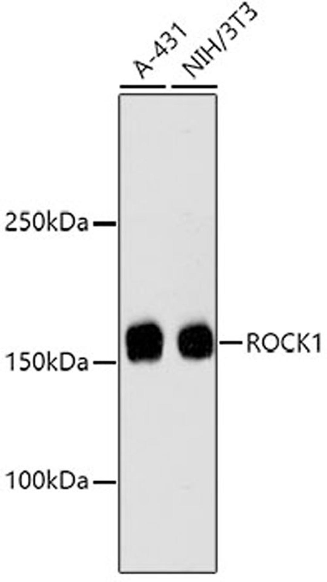 Western blot - ROCK1 antibody (A11158)