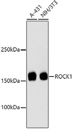 Western blot - ROCK1 antibody (A11158)