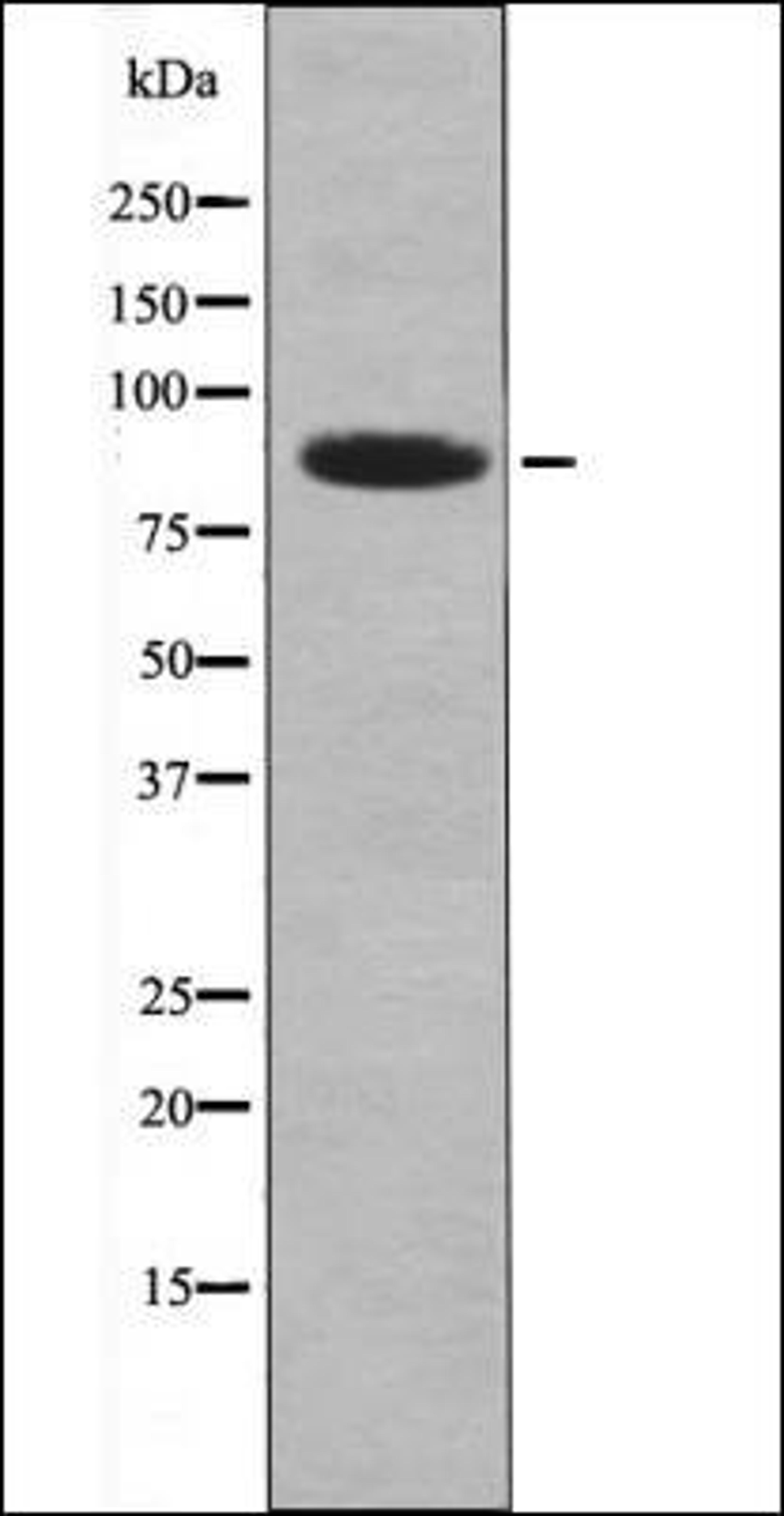 Western blot analysis of HeLa whole cell lysates using MARK1/2/3/4 -Phospho-Thr215- antibody