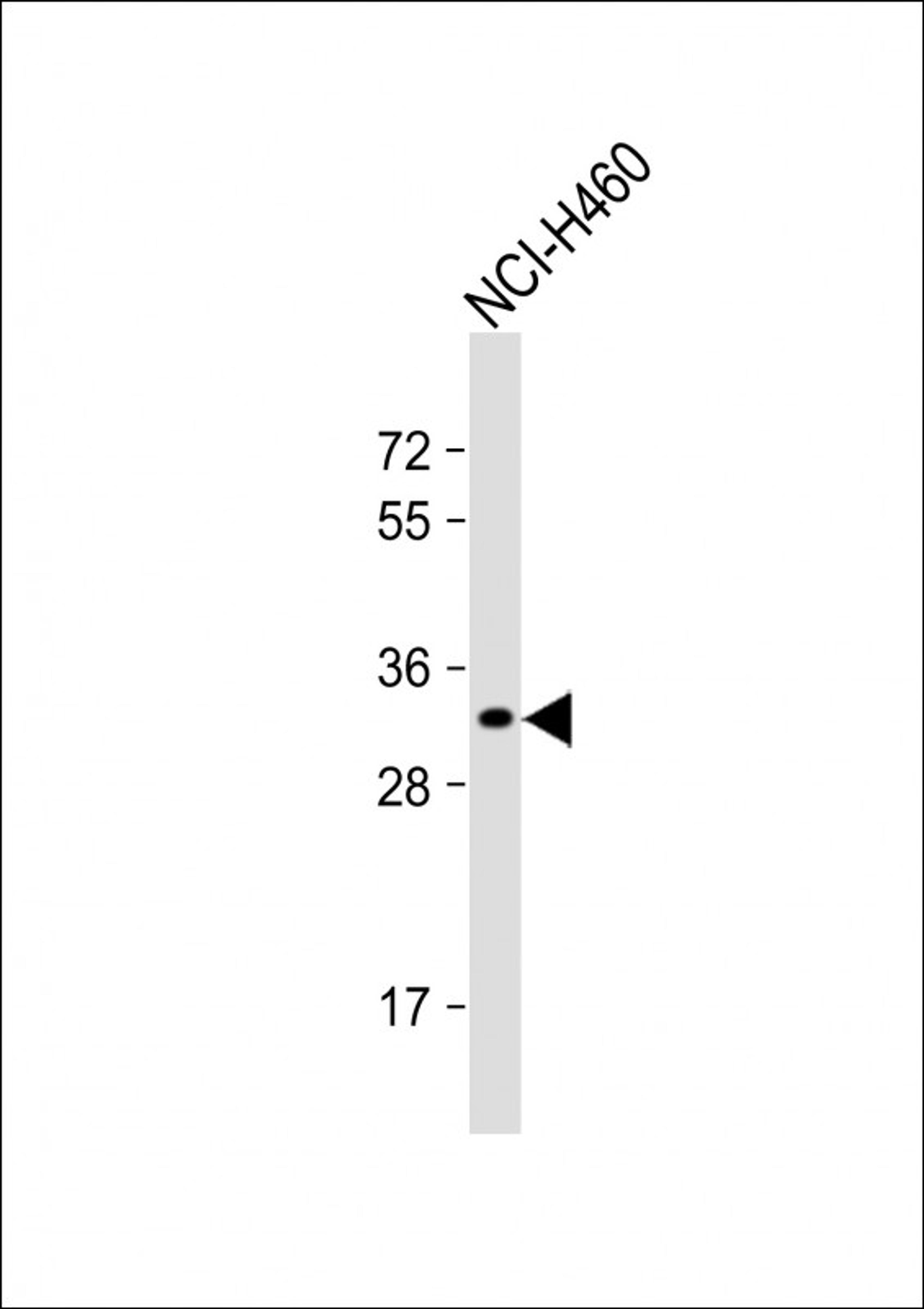 Western Blot at 1:1000 dilution + NCI-H460 whole cell lysate Lysates/proteins at 20 ug per lane.