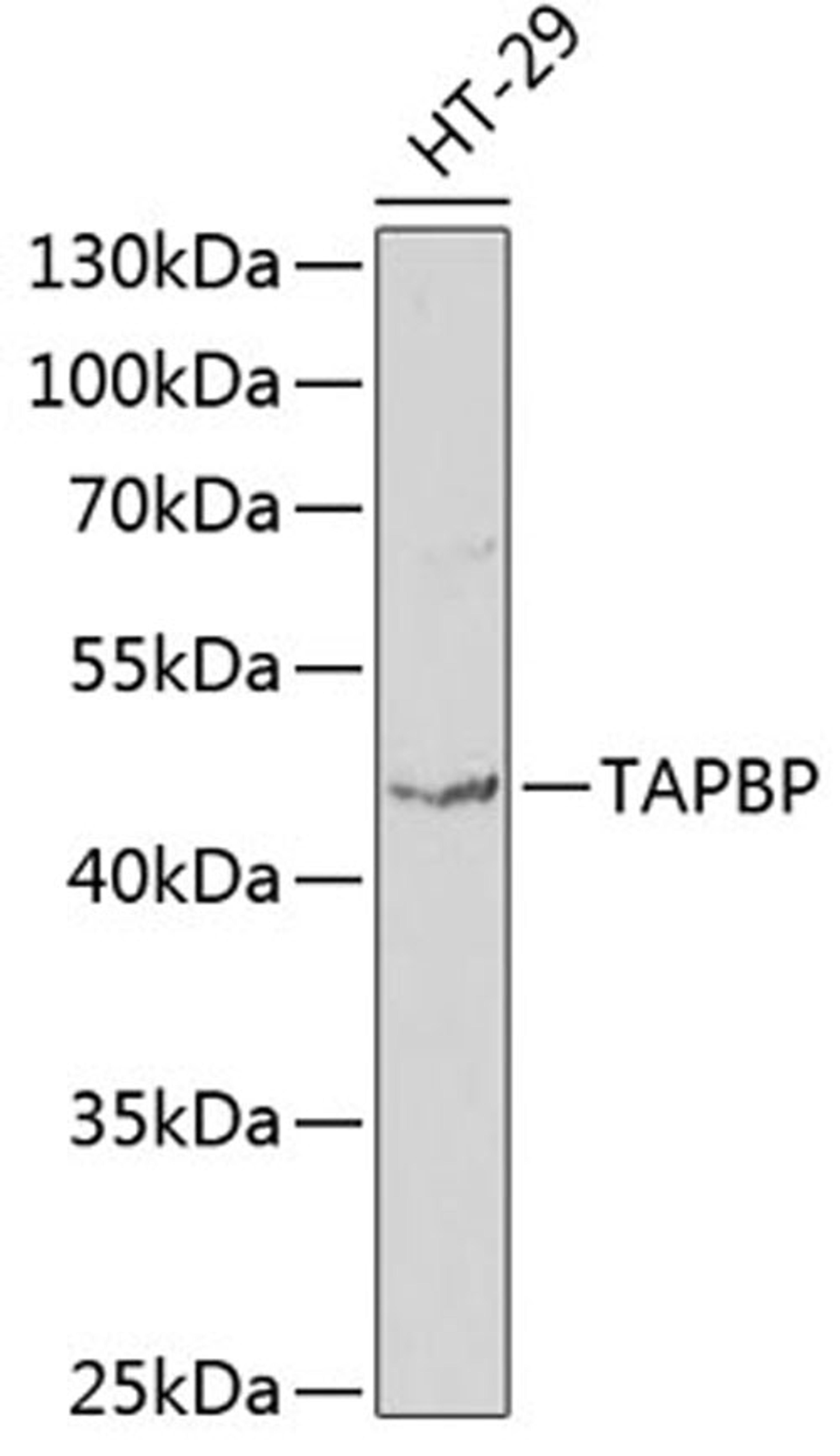 Western blot - TAPBP antibody (A1968)