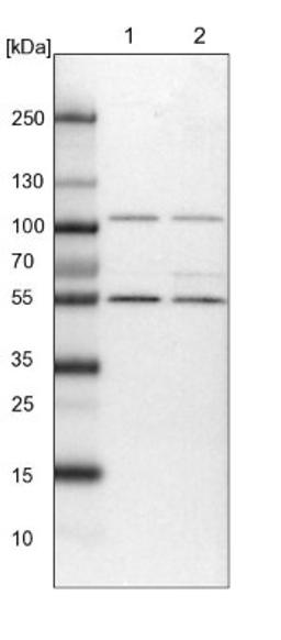 Western Blot: HPCL Antibody [NBP1-89384] - Lane 1: NIH-3T3 cell lysate (Mouse embryonic fibroblast cells)<br/>Lane 2: NBT-II cell lysate (Rat Wistar bladder tumour cells)