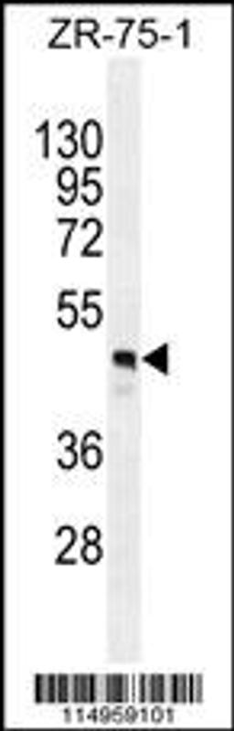 Western blot analysis in ZR-75-1 cell line lysates (35ug/lane).