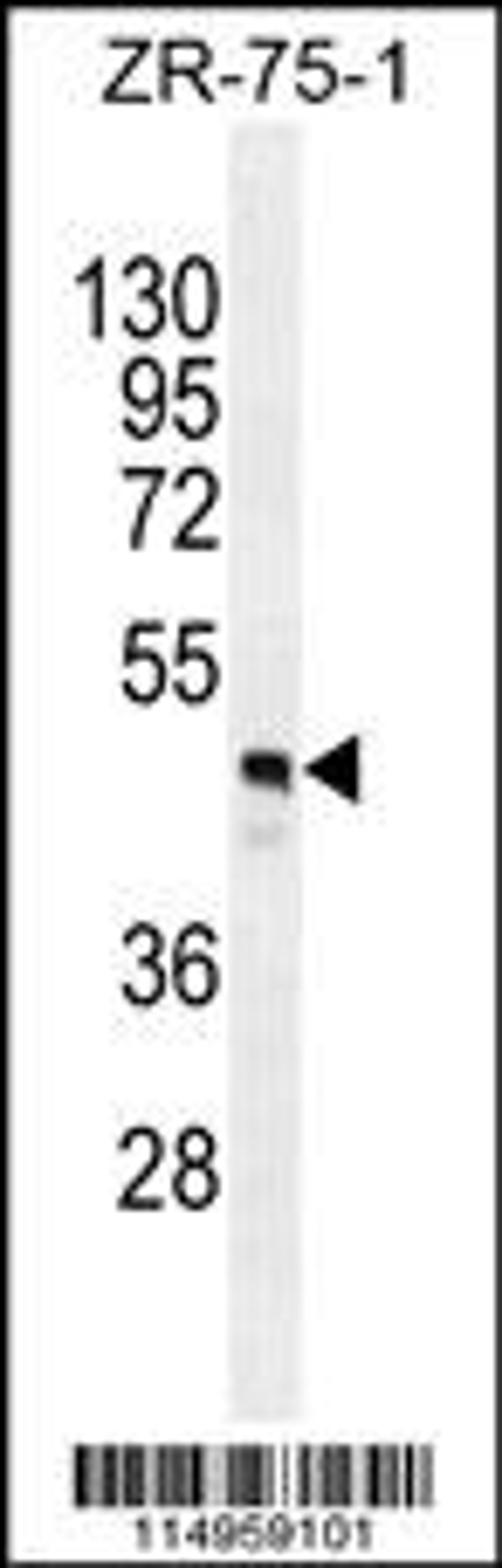 Western blot analysis in ZR-75-1 cell line lysates (35ug/lane).