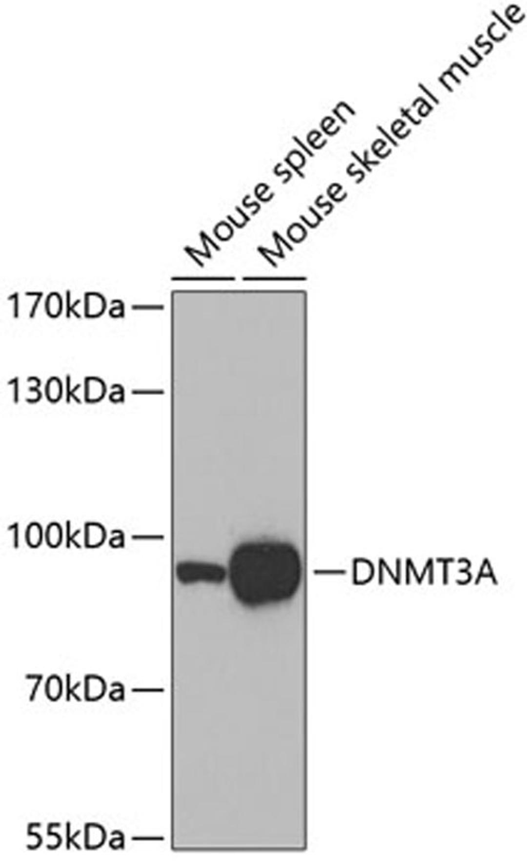 Western blot - DNMT3A antibody (A3169)