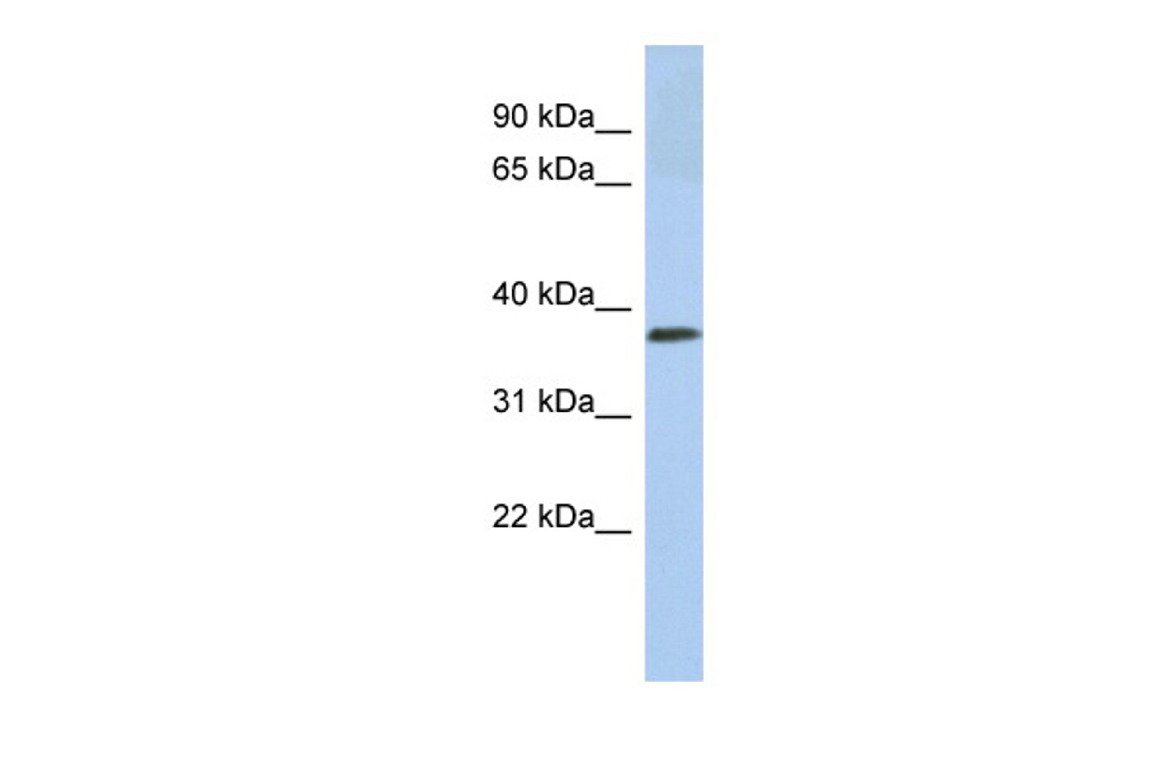 Antibody used in WB on Human Jurkat 0.2-1 ug/ml.