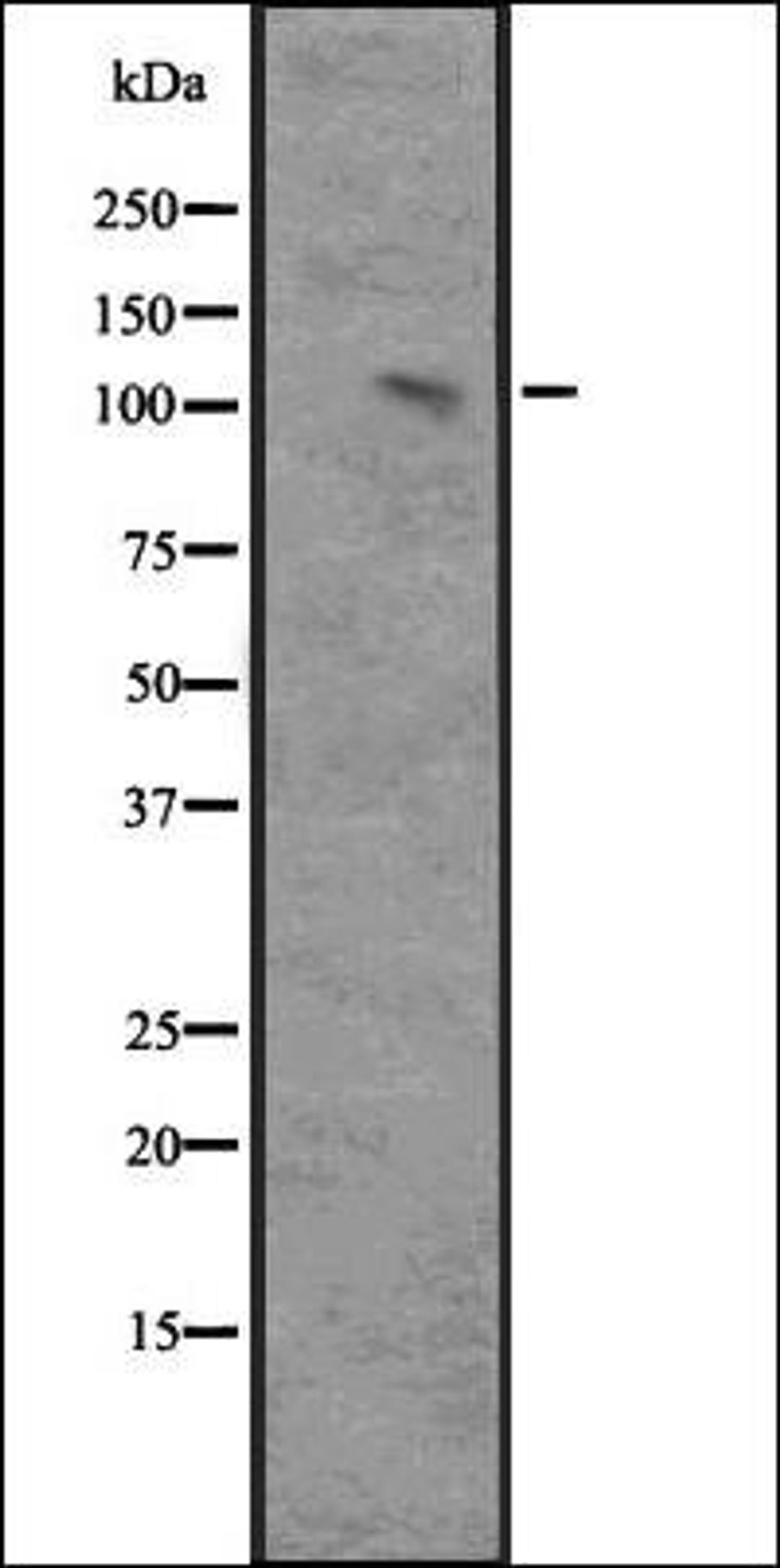 Western blot analysis of Ant NIK-transfected 293 cell lysate using MAP3K14 antibody