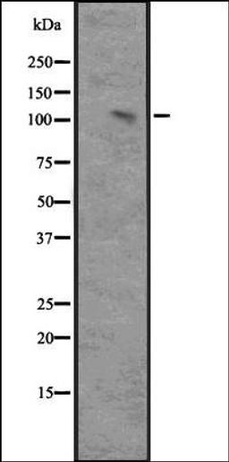 Western blot analysis of Ant NIK-transfected 293 cell lysate using MAP3K14 antibody