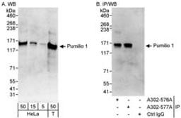 Detection of human Pumilio 1 by western blot and immunoprecipitation.