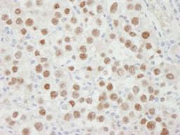 Detection of human MCM5 by immunohistochemistry.