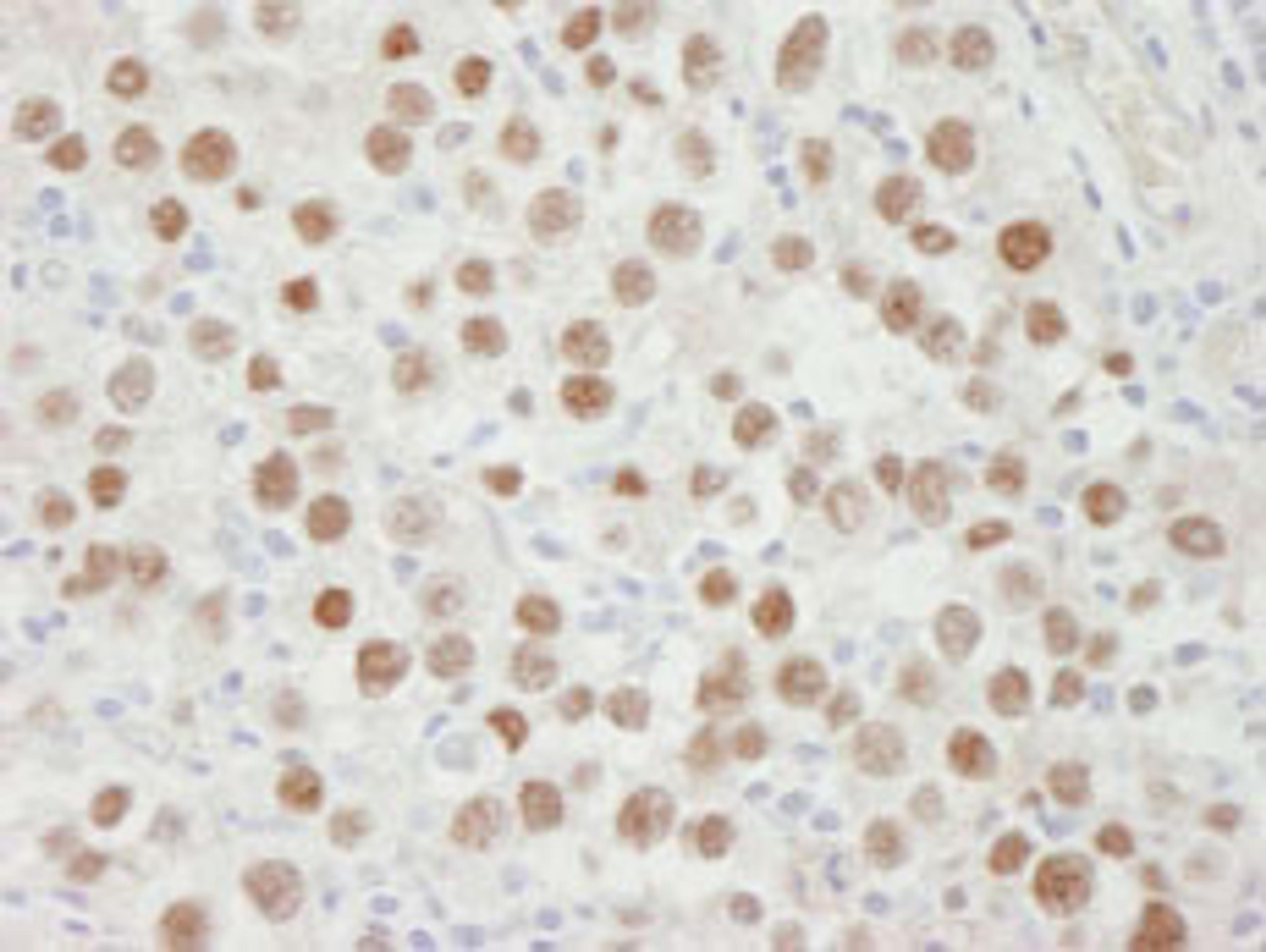 Detection of human MCM5 by immunohistochemistry.