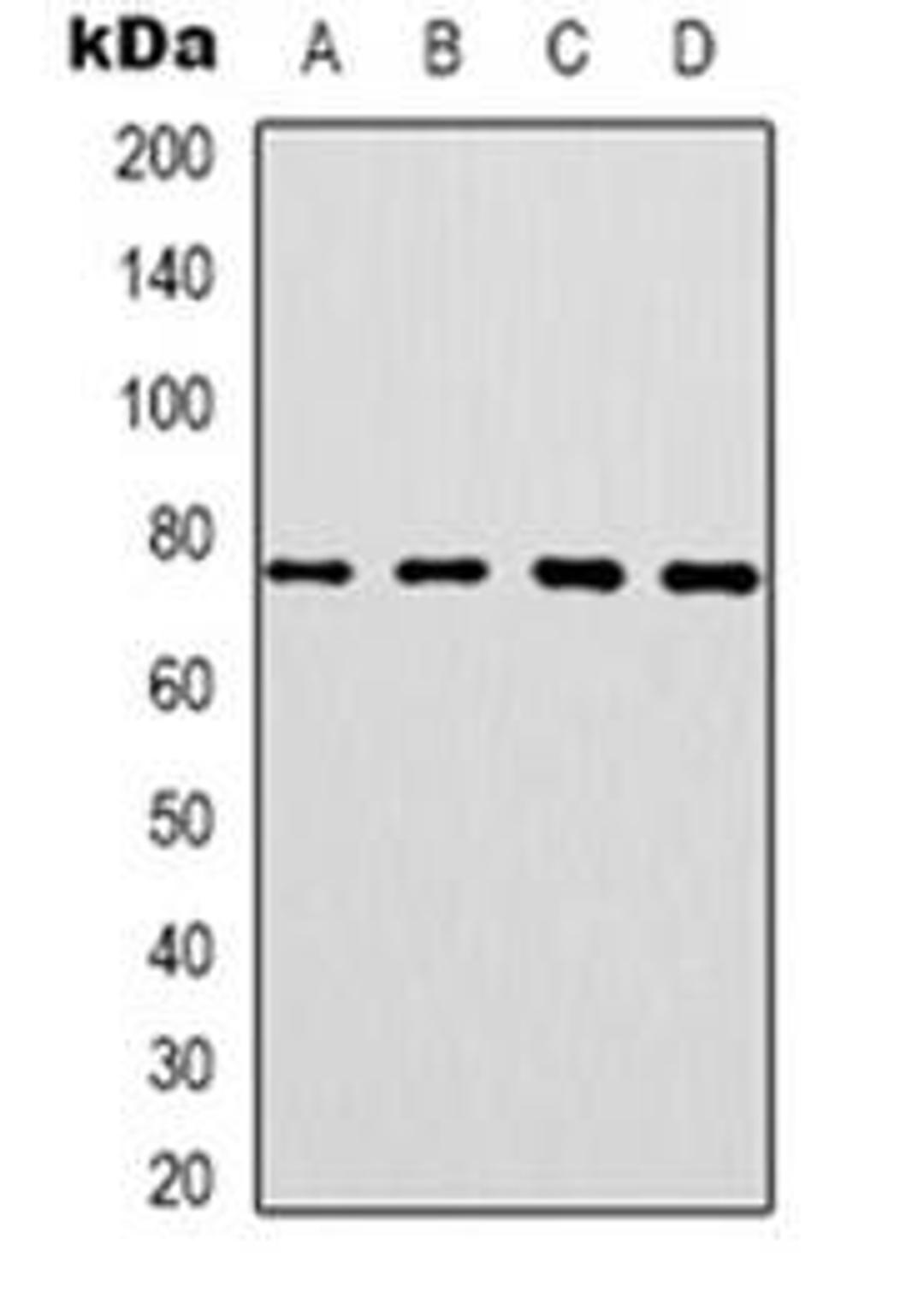 Western blot analysis of CEP76 expression in SKOV3 (Lane 1), HT29 (Lane 2), HepG2 (Lane 3), NIH3T3 (Lane 4) whole cell lysates using CEP76 antibody