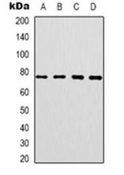 Western blot analysis of CEP76 expression in SKOV3 (Lane 1), HT29 (Lane 2), HepG2 (Lane 3), NIH3T3 (Lane 4) whole cell lysates using CEP76 antibody